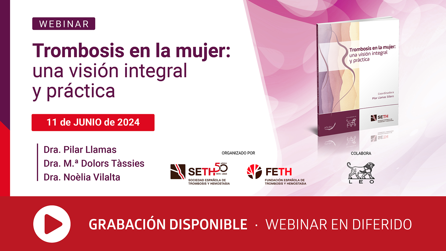 Trombosis en la mujer: una visión integral y práctica