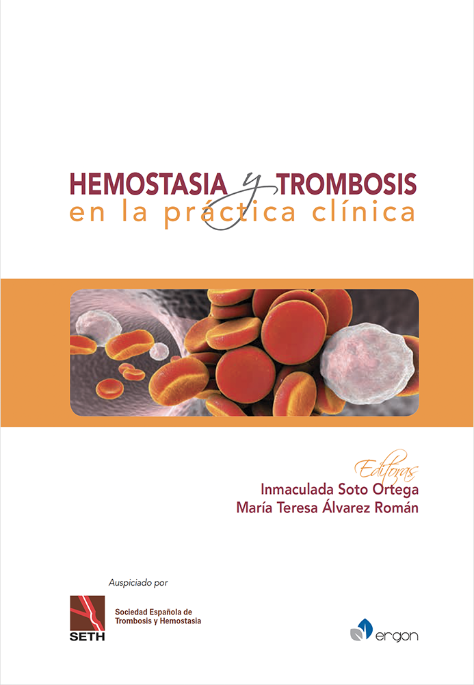 Hemostasia y Trombosis en la práctica clínica