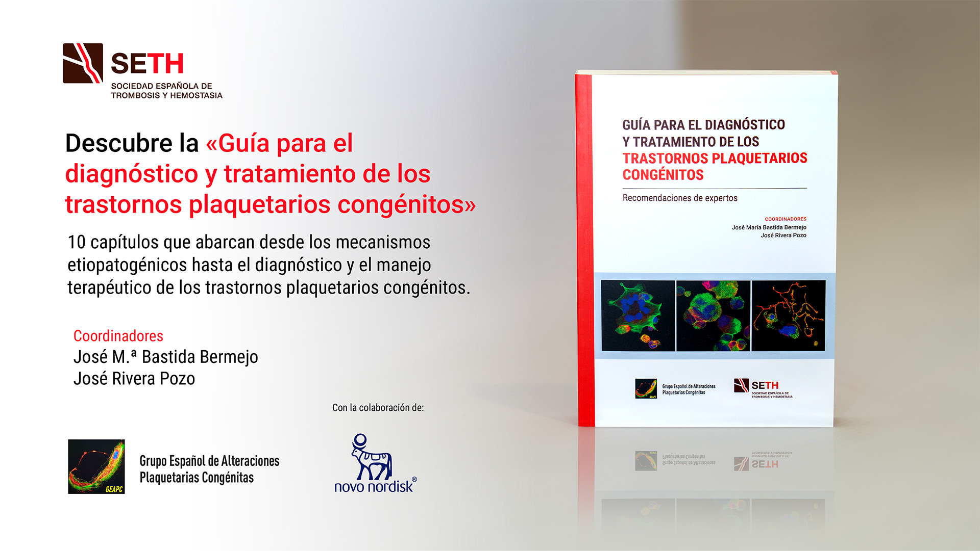 Guía para el diagnóstico y tratamiento de los trastornos plaquetarios congénitos