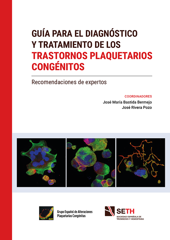 Guía para el diagnóstico y tratamiento de los trastornos plaquetarios congénitos
